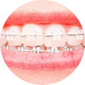 brackets