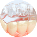 brackets