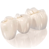 implant