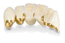 implant