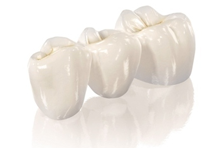 implant