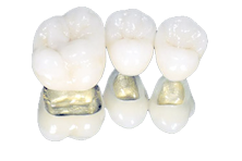 implant